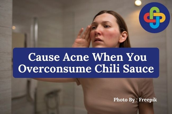 3 Things That Cause Acne When You Overconsume Chili Sauce